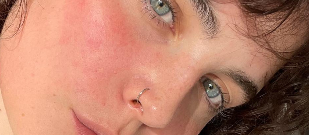 piel con rosacea piel sensible mamita botanical