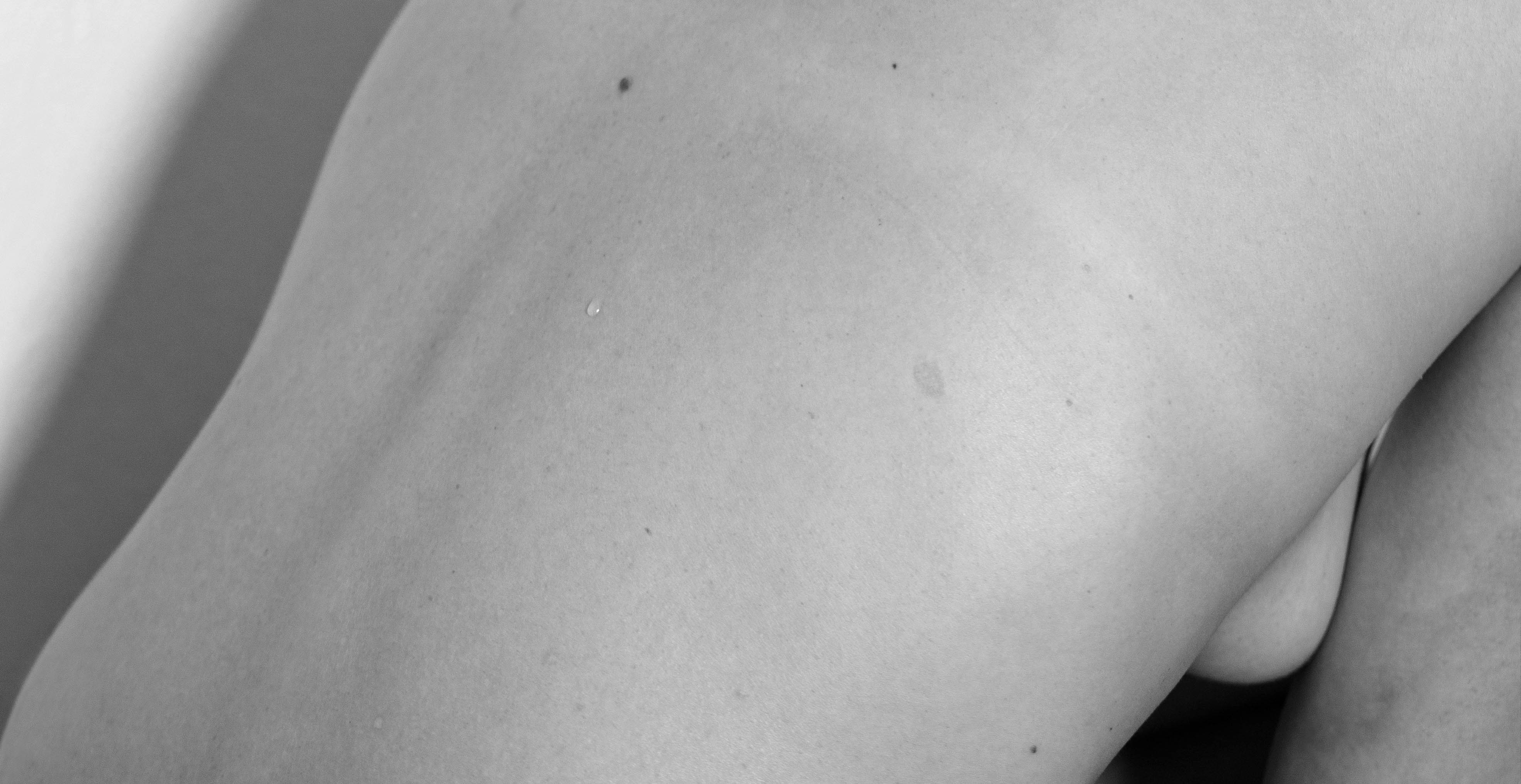 MICROBIOTA Y PIEL
