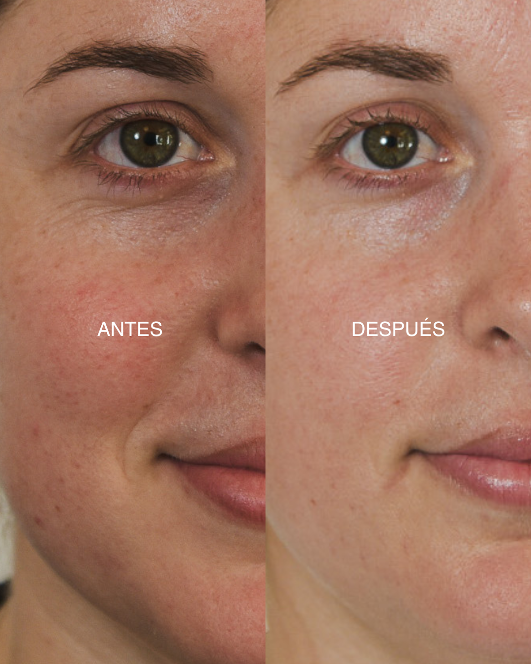 1-014 PRO-RESISTANCE SERUM