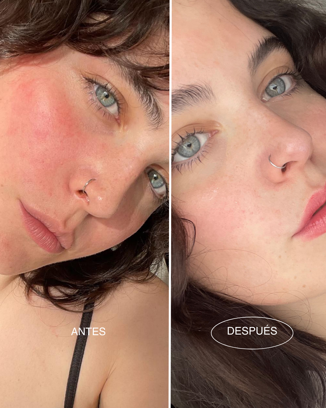 rutina-antes-despues-piel-sensible-mamita-botanical