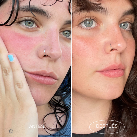 serum-super-linda-antes-despues-piel-sensible-mamita-botanical